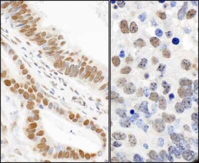 Immunohistochemistry-Paraffin: 53BP1 [p Ser25] Antibody [NB100-1803]